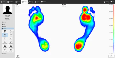 Dynamic impulse picture